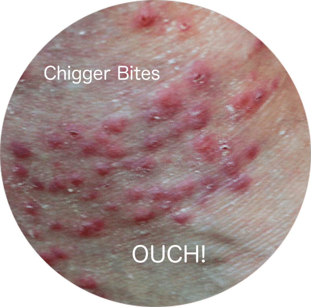 how to repel chiggers